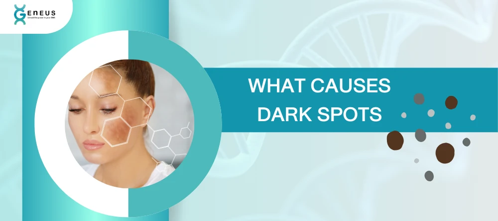 What Causes Dark Spots on Face?