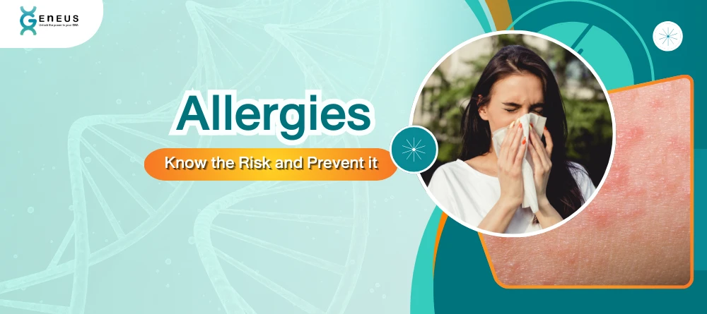 Allergies