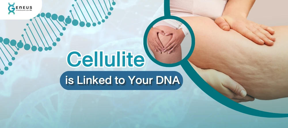 Cellulite