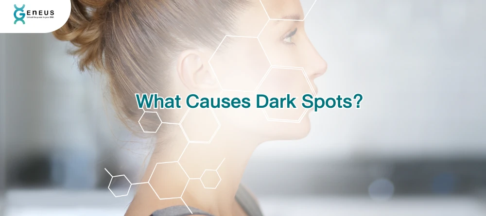 Dark Spots