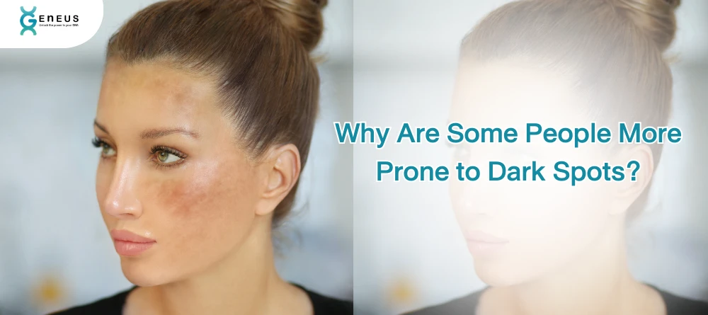 More Prone To Dark Spots