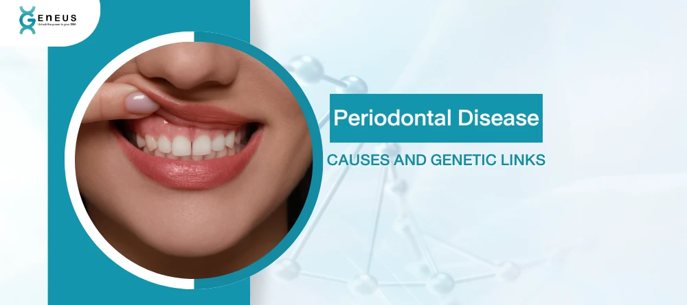 Periodontal Disease: Causes, Genetic Links, and How to Prevent It