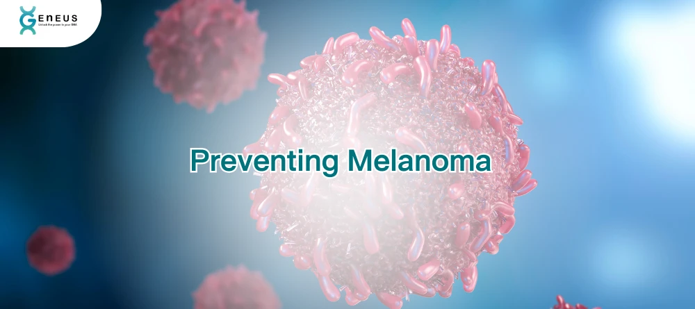 Preventing Melanoma
